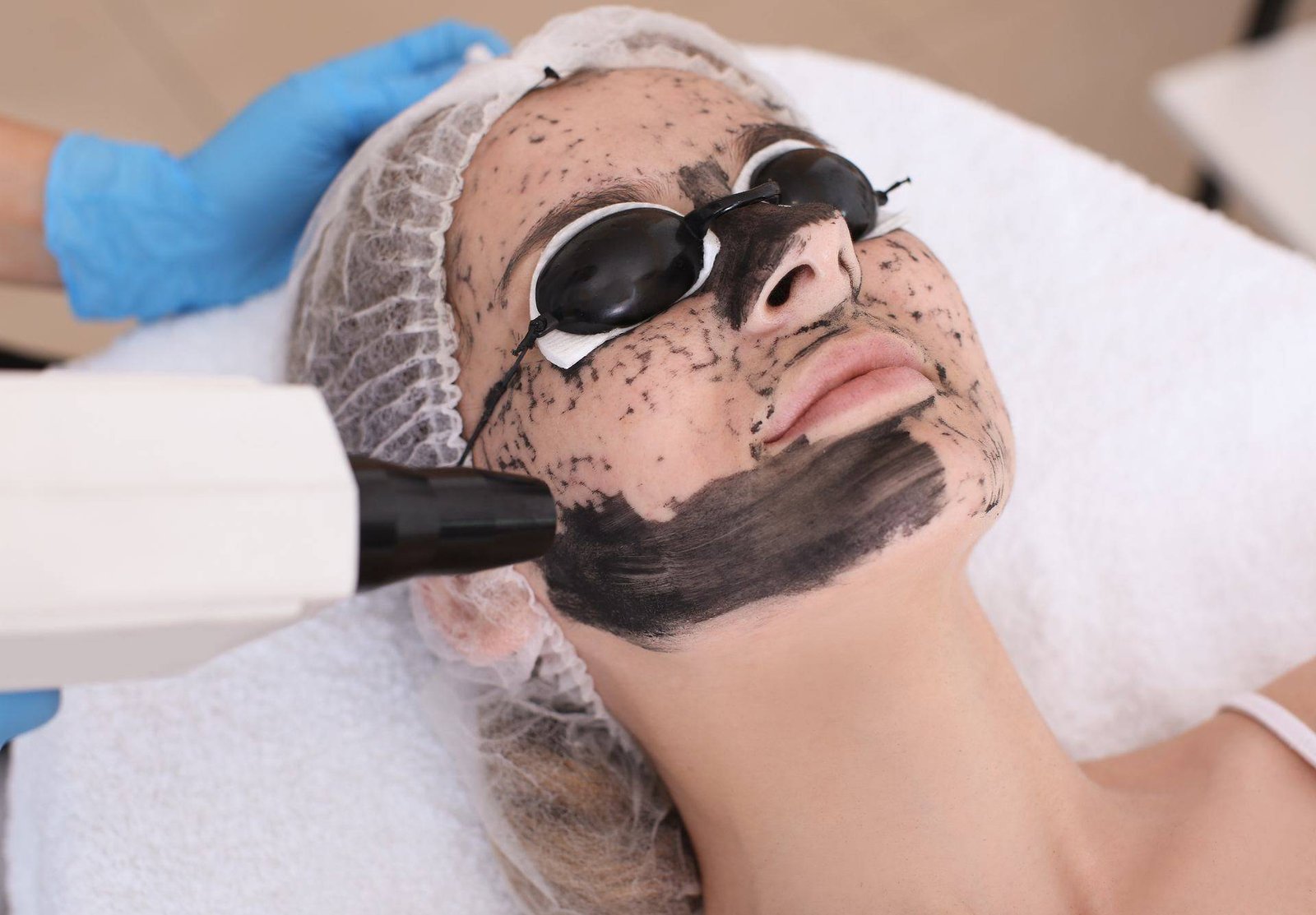 Carbon Facial Treatment in Lahore | Dr Zarqa